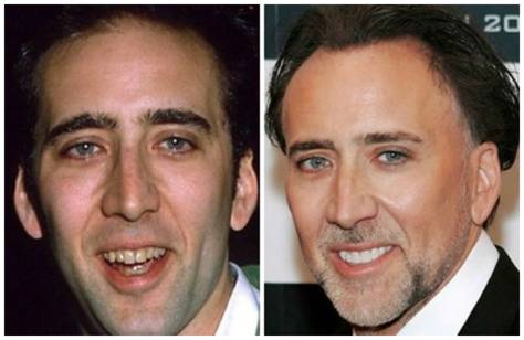 chelsea peretti tom cruise famous hollywood celebrities masquerading with fake teeth chelsea peretti tom cruise famous hollywood celebrities masquerading with fake teeth